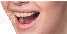 Gesunde Zähne Moers