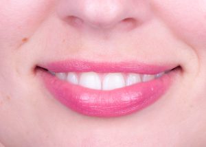 Zahnsanierung Zahnarztpraxis Moers